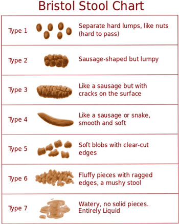 Bristol Stool Chart